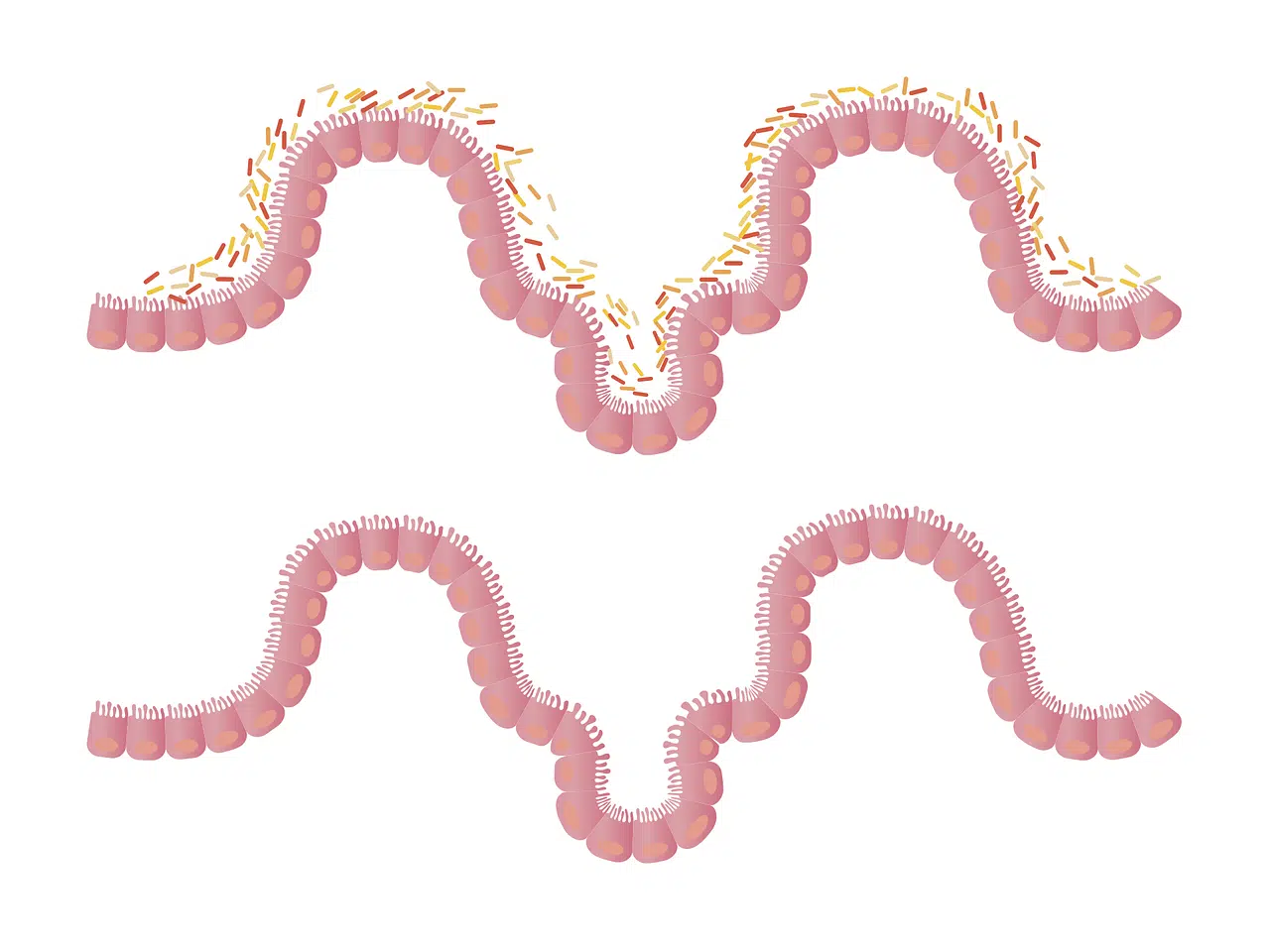 Microbiota o flora intestinal. 