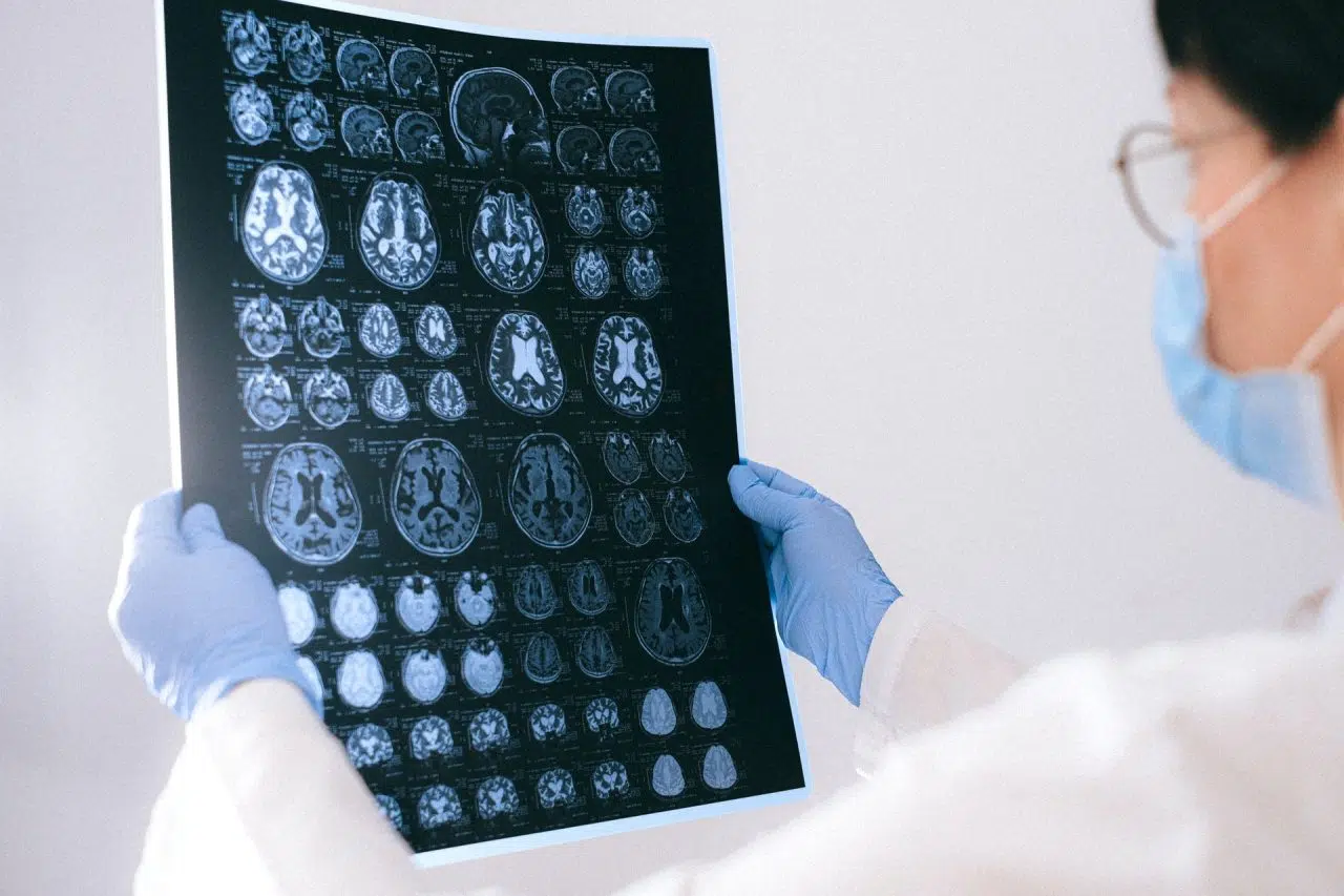 Paramnesia, patología vinculada a la memoria.